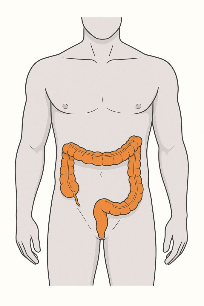 대장암의 위치를 설명하는 의료 일러스트