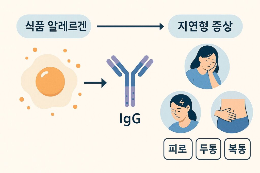 지연성 음식 알레르기 면역 반응 인포그래픽