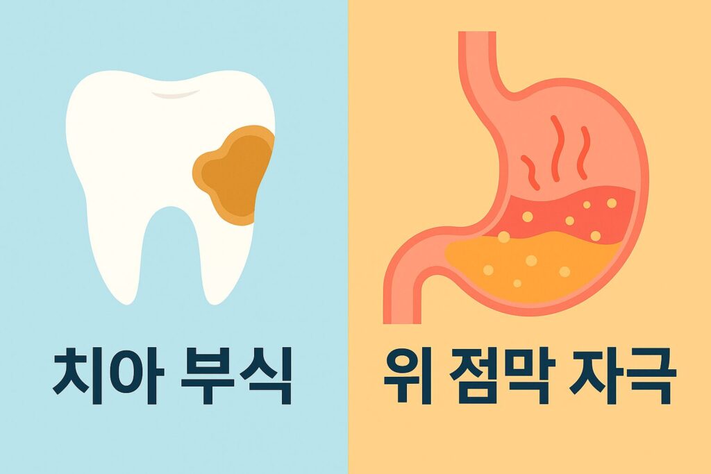 치아 부식과 위 점막 자극을 명확하게 표현한 인포그래픽